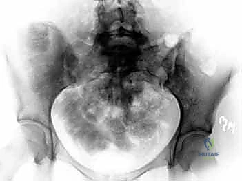 استخدام أجهزة التصوير المتقدمة