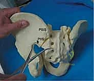 التعامل مع الأنسجة العميقة