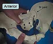 صورة طبية: جراحة الرد المفتوح والتثبيت الداخلي لكسور الحوض والعجز: دليل المرضى الشامل مع الأستاذ الدكتور محمد هطيف في صنعاء
