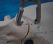 صورة طبية: جراحة الرد المفتوح والتثبيت الداخلي لكسور الحوض والعجز: دليل المرضى الشامل مع الأستاذ الدكتور محمد هطيف في صنعاء