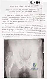 صورة طبية: إعادة بناء الأطراف الاصطناعية الداخلية: أمل جديد لمرضى أورام العظام مع الأستاذ الدكتور محمد هطيف