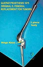 صورة تاريخية توضح تطور الغرسات العظمية