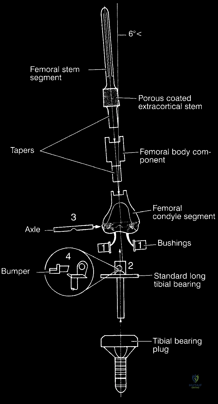 الأستاذ الدكتور محمد هطيف أثناء إجراء جراحة معقدة لإنقاذ طرف