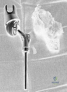 فحص سريري يوضح تورم في منطقة الركبة