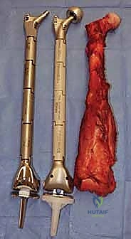 التحقق من الهوامش الآمنة بعد الاستئصال