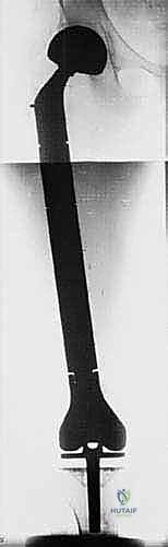 أجزاء من نظام طرف اصطناعي داخلي معياري قبل التجميع