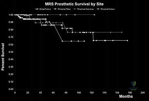 صورة طبية: إعادة بناء الأطراف الاصطناعية الداخلية: أمل جديد لمرضى أورام العظام مع الأستاذ الدكتور محمد هطيف