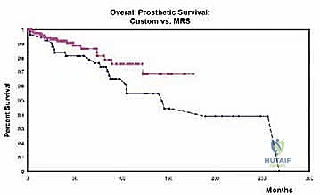 صورة طبية: إعادة بناء الأطراف الاصطناعية الداخلية: أمل جديد لمرضى أورام العظام مع الأستاذ الدكتور محمد هطيف