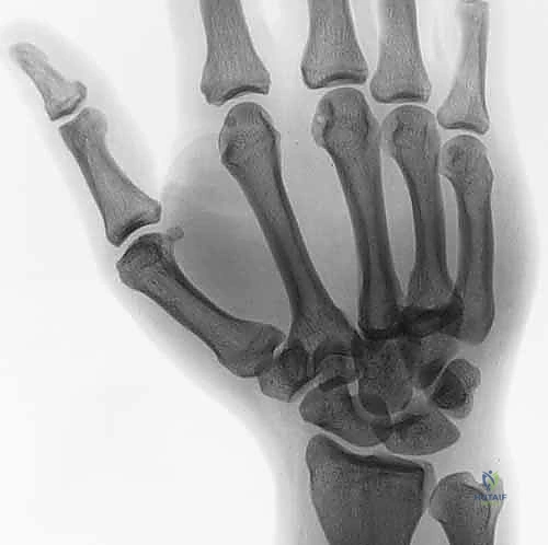 استخدام الأشعة المقطعية في التخطيط الجراحي