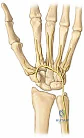الأعراض السريرية وتورم اليد بعد الإصابة