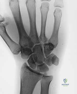 التخطيط الجراحي الدقيق لضمان أفضل النتائج