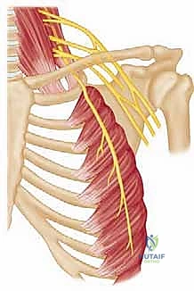 شكل توضيحي لموقع العصب الصدري الطويل السطحي، مما يجعله عرضة للإصابة