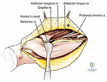 التشريح الدقيق للفخذ والعضلة الرباعية