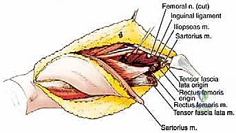 التشخيص الإشعاعي والرنين المغناطيسي لتقييم الورم