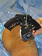 الأشعة السينية الطويلة للطرف السفلي لتحديد زوايا التشوه والمحور الميكانيكي