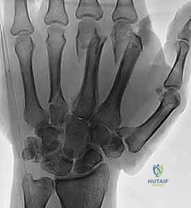 تخطيط ما قبل الجراحة