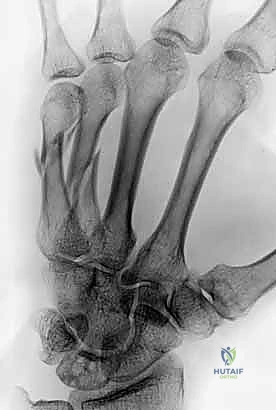 تجهيز المريض للعملية