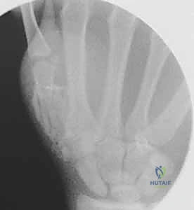 خيارات التثبيت