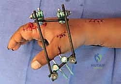 خطوة جراحية 6