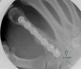 تقييم الكسر بالأشعة