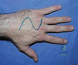 الفحص السريري لليد