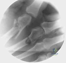 دقة العمل الجراحي