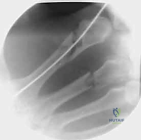 أشعة بعد الجراحة 10