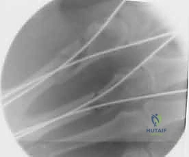 خطوة جراحية 8