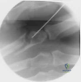 حالة سريرية 5