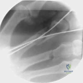 أشعة بعد الجراحة 2