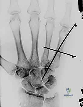 متابعة ما بعد الجراحة 1