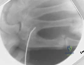 أشعة بعد الجراحة 7