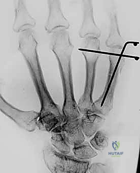 متابعة ما بعد الجراحة 2