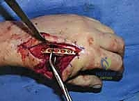 أشعة بعد الجراحة 9