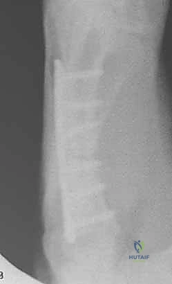 متابعة ما بعد الجراحة 4