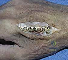 أشعة بعد الجراحة 11