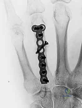 دقة العمل الجراحي