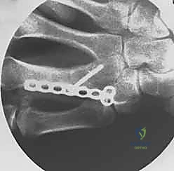 حالة سريرية 6