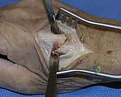 أشعة بعد الجراحة 3