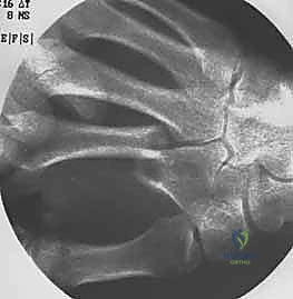 حالة سريرية 4