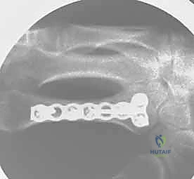 أشعة بعد الجراحة 4