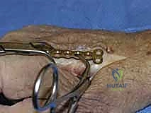 حالة سريرية 3