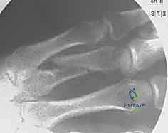 حالة سريرية 7