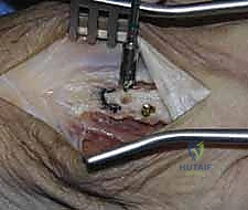 أشعة بعد الجراحة 12