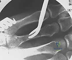 أشعة بعد الجراحة 6