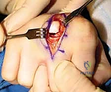 أشعة بعد الجراحة 8