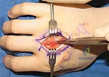 متابعة ما بعد الجراحة 3