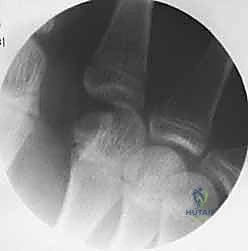 دقة العمل الجراحي