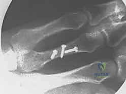 دقة العمل الجراحي