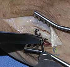 أشعة بعد الجراحة 5